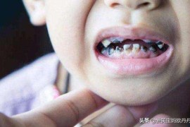 幼兒刷牙短視頻教程_如何給嬰幼兒刷牙