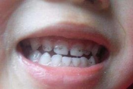 嬰兒刷短視頻教程_如何為1歲半到2歲的寶寶做輔食