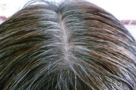 白發(fā)剪短視頻教程_兩分鐘后老人痛苦哀嚎