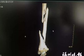 抖音怎么把別人的視頻變成自己的_好友的抖音短視頻分享界面為什么和其他人的不一樣而且無法轉(zhuǎn)發(fā)